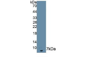 Detection of Recombinant IL18R1, Human using Monoclonal Antibody to Interleukin 18 Receptor 1 (IL18R1) (IL18R1 抗体  (AA 375-428))