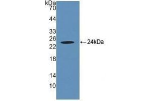 Detection of Recombinant CRYaB, Human using Polyclonal Antibody to Crystallin Alpha B (CRYaB) (CRYAB 抗体  (AA 1-175))