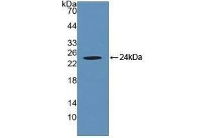 Detection of Recombinant CRYaB, Human using Polyclonal Antibody to Crystallin Alpha B (CRYaB)