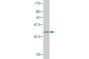 Western Blot detection against Immunogen (37. (STYK1 抗体  (AA 50-159))