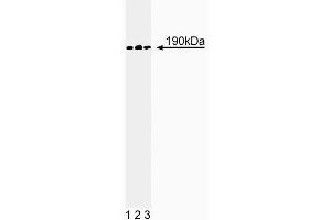 Western blot analysis of p190-B on a A431 cell lysate (Human epithelial carcinoma, ATCC CRL-1555).
