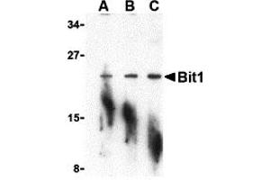 Western Blotting (WB) image for anti-Peptidyl-tRNA Hydrolase 2 (PTRH2) (N-Term) antibody (ABIN1031275) (PTRH2 抗体  (N-Term))
