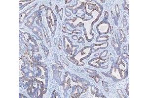 IHC analysis of Cytokeratin 20/Krt20 using anti-Cytokeratin 20/Krt20 antibody (ABIN7601133). (KRT20 抗体  (AA 29-431))