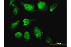 Immunofluorescence of monoclonal antibody to HOXD11 on HeLa cell. (HOXD11 抗体  (AA 1-76))