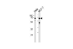 FOXO3 Antibody (N-term) (ABIN657229 and ABIN2846331) western blot analysis in Hela,MCF-7 cell line lysates (35 μg/lane). (FOXO3 抗体  (N-Term))