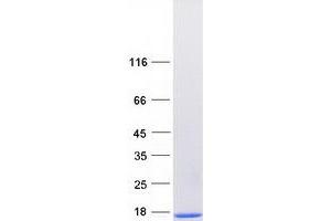 Western Blotting (WB) image for S100 Calcium Binding Protein A3 (S100A3) protein (Myc-DYKDDDDK Tag) (ABIN2731305)