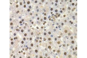 Immunohistochemistry of paraffin-embedded Rat liver using TOR1A Polyclonal Antibody at dilution of 1:200 (40x lens). (TOR1A 抗体)