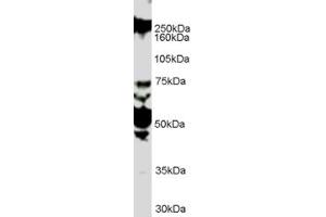 Western Blotting (WB) image for anti-Roundabout, Axon Guidance Receptor, Homolog 1 (ROBO1) (Internal Region) antibody (ABIN2466219) (ROBO1 抗体  (Internal Region))