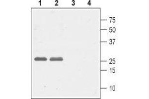 Western blot analysis of rat (lanes 1 and 3) and mouse (lanes 2 and 4) brain lysates: - 1,2. (CACNG5 抗体  (1st Extracellular Loop))