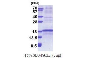 SDS-PAGE (SDS) image for Ribosomal Protein L34 (RPL34) (AA 1-117) protein (His tag) (ABIN5853251) (RPL34 Protein (AA 1-117) (His tag))