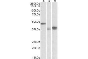 AP23763PU-N TXNDC5 antibody staining of Mouse Lymph Nodes (A), Stomach (B) and Intestine (C) lysates at 0. (TXNDC5 抗体  (Internal Region))
