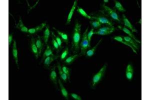 Immunofluorescence staining of Hela cells with ABIN7169262 at 1:333, counter-stained with DAPI. (PPP2R4 抗体  (AA 1-250))