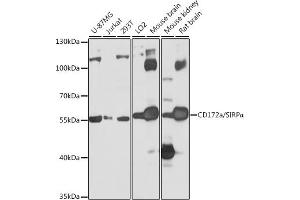 Western blot analysis of extracts of various cell lines, using CD172a/SIRPα antibody (ABIN6130058, ABIN6147780, ABIN6147781 and ABIN6224854) at 1:1000 dilution. (SIRPA 抗体  (AA 395-504))