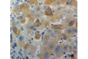 Used in DAB staining on fromalin fixed paraffin-embedded Liver tissue (LTA 抗体  (AA 36-205))