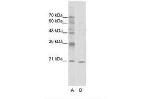 Image no. 1 for anti-Visual System Homeobox 1 (VSX1) (N-Term) antibody (ABIN202105) (VSX1 抗体  (N-Term))