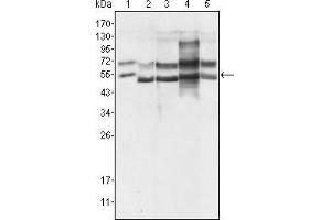 Western Blot showing using GABPA antibody used against Hela (1), A549 (2), MCF-7 (3), NIH/3T3 (4) and SMMC-7721 (5) cell lysate. (GABPA 抗体  (AA 120-190))
