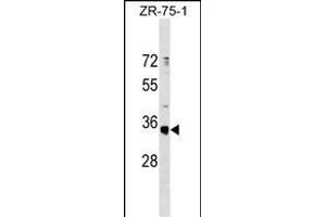 OR51G1 Antibody (C-term) (ABIN1537059 and ABIN2849831) western blot analysis in ZR-75-1 cell line lysates (35 μg/lane). (OR51G1 抗体  (C-Term))