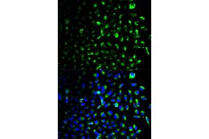 Immunofluorescence analysis of U2OS cells using HK1 antibody (ABIN5970413). (Hexokinase 1 抗体)