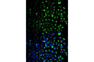 Immunofluorescence analysis of U2OS cells using HK1 antibody (ABIN5970413). (Hexokinase 1 抗体)