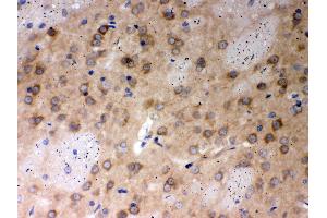Immunohistochemistry (IHC) image for anti-Protein Phosphatase 2, Catalytic Subunit, alpha Isozyme (PPP2CA) (AA 1-309) antibody (ABIN3043356)
