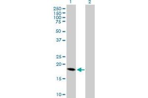 Western Blot analysis of CRH expression in transfected 293T cell line by CRH MaxPab polyclonal antibody. (CRH 抗体  (AA 1-196))