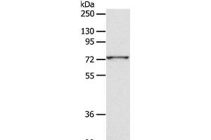Western Blot analysis of PC3 cell using CD156c Polyclonal Antibody at dilution of 1:300 (ADAM10 抗体)