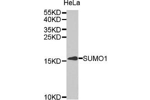 Western blot analysis of extracts of HeLa cell line, using SUMO1 antibody. (SUMO1 抗体)