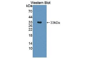 Western blot analysis of the recombinant protein. (IGFBP6 抗体  (AA 31-240))