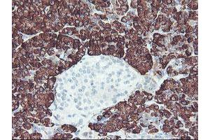 Image no. 4 for anti-Carboxypeptidase A2 (Pancreatic) (CPA2) antibody (ABIN1497594) (Carboxypeptidase A2 抗体)
