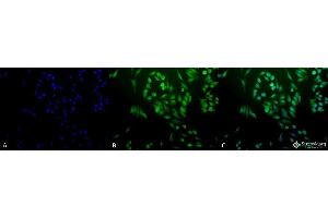 Immunocytochemistry/Immunofluorescence analysis using Rabbit Anti-Ubiquitin Polyclonal Antibody . (Ubiquitin 抗体  (Atto 488))