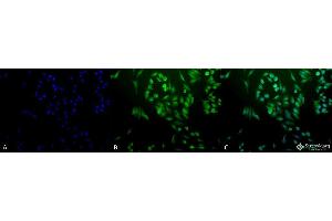 Immunocytochemistry/Immunofluorescence analysis using Rabbit Anti-Ubiquitin Polyclonal Antibody .