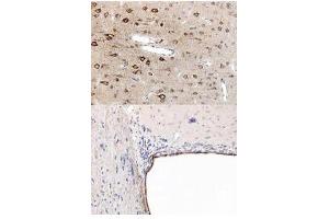Immunohistochemistry (IHC) image for anti-Peroxisome Proliferator-Activated Receptor alpha (PPARA) (N-Term) antibody (ABIN105798) (PPARA 抗体  (N-Term))