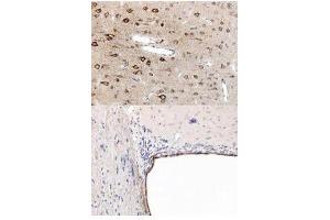 Immunohistochemistry (IHC) image for anti-Peroxisome Proliferator-Activated Receptor alpha (PPARA) (N-Term) antibody (ABIN1043876) (PPARA 抗体  (N-Term))