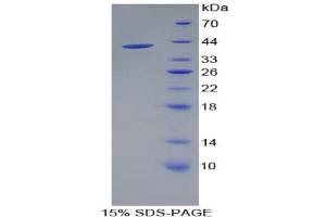 SDS-PAGE analysis of Rat Cadherin 5 Protein. (Cadherin 5 Protein (CDH5))