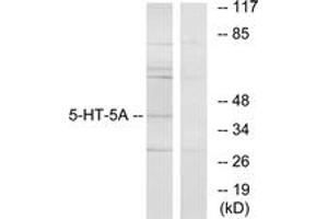 Western Blotting (WB) image for anti-Serotonin Receptor 5A (HTR5A) (AA 211-260) antibody (ABIN2889849) (Serotonin Receptor 5A 抗体  (AA 211-260))