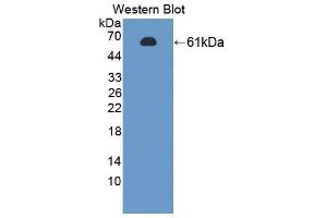Western blot analysis of the recombinant protein. (PTBP1 抗体  (AA 1-531))