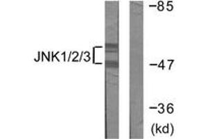 Western blot analysis of extracts from 293 cells, treated with UV 5', using JNK1/2/3 (Ab-183/185) Antibody. (JNK 抗体  (AA 151-200))