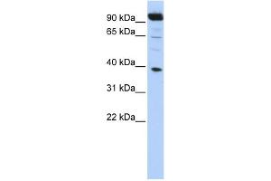 WB Suggested Anti-HOXB2 Antibody Titration:  0. (HOXB2 抗体  (N-Term))