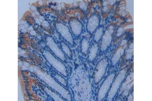 Used in DAB staining on fromalin fixed paraffin- embedded intestine tissue (ENPP7 抗体  (AA 22-439))