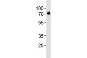 Western blot analysis of lysate from SH-SY5Y cell line using DBH antibody at 1:1000. (DBH 抗体  (AA 199-232))