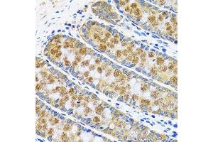 Immunohistochemistry (Paraffin-embedded Sections) (IHC (p)) image for anti-Glutamic-Oxaloacetic Transaminase 1, Soluble (Aspartate Aminotransferase 1) (GOT1) (AA 244-413) antibody (ABIN6141283)