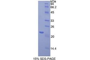 SDS-PAGE analysis of Mouse Toll Like Receptor 3 Protein. (TLR3 蛋白)