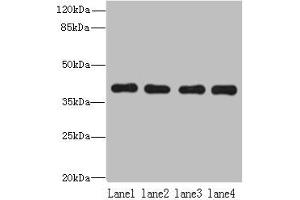 Western blot All lanes: NUDT9 antibody at 8 μg/mL Lane 1: Raji whole cell lysate Lane 2: Jurkat whole cell lysate Lane 3: Mouse kidney tissue Lane 4: Hela whole cell lysate Secondary Goat polyclonal to rabbit IgG at 1/10000 dilution Predicted band size: 40, 34 kDa Observed band size: 40 kDa (NUDT9 抗体  (AA 47-350))