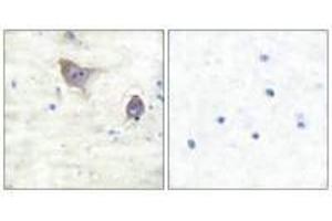 Immunohistochemical analysis of paraffin-embedded human brain tissue using Synuclein β antibody. (beta Synuclein 抗体)