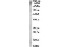 Image no. 2 for anti-TBC1 Domain Family, Member 4 (TBC1D4) (Internal Region) antibody (ABIN374867) (TBC1D4 抗体  (Internal Region))