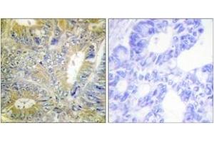 Immunohistochemistry (IHC) image for anti-Desmin (DES) (AA 26-75) antibody (ABIN1532766)