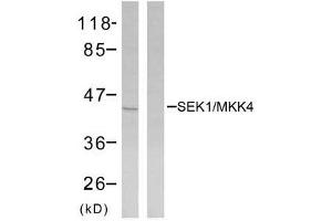 Western blot analysis of extracts from NIH/3T3 cells using SEK1/MKK4 (Ab-80) antibody (E021132). (MAP2K4 抗体)