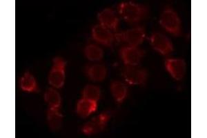 ABIN6279061 staining HepG2 by IF/ICC. (ACAD11 抗体  (Internal Region))