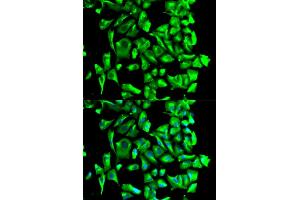 Immunofluorescence analysis of U2OS cells using HSP90AB1 antibody. (HSP90AB1 抗体)