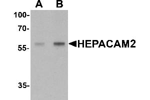 Western Blotting (WB) image for anti-HEPACAM Family Member 2 (HEPACAM2) (C-Term) antibody (ABIN1077405) (HEPACAM2 抗体  (C-Term))